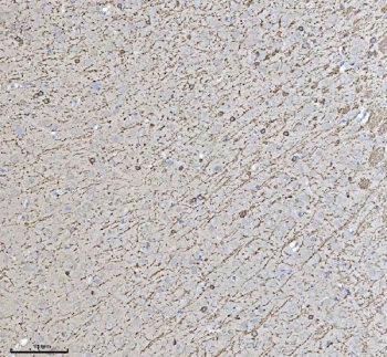 IHC staining of FFPE rat brain tissue with CNP antibody. HIER: boil tissue sections in pH8 EDTA for 20 min and allow to cool before testing.