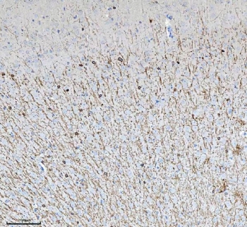 IHC staining of FFPE mouse brain tissue with CNP antibody. HIER: boil tissue sections in pH8 EDTA for 20 min and allow to cool before testing.