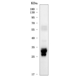 Western blot testing of human Daudi cell lysate with CD74 antibody. Expected molecular weight: 33-43 kDa.