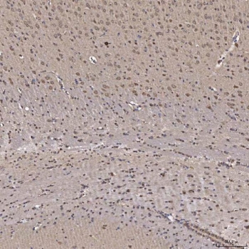 IHC staining of FFPE rat brain tissue with NOB1 antibody. HIER: boil tissue sections in pH8 EDTA for 20 min and allow to cool before testing.