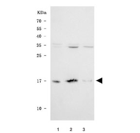 Western blot testing of human 1) HeLa, 2) RT4 and 3) HaCaT cell lysate with SNCG antibody. Expected molecular weight: 13-17 kDa.