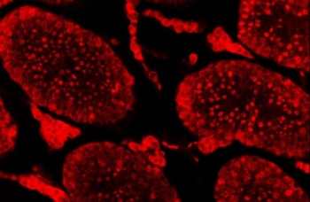 Immunofluorescent staining of FFPE mouse testis tissue with SAE1 antibody. HIER: steam section in pH8 EDTA buffer for 20 min.