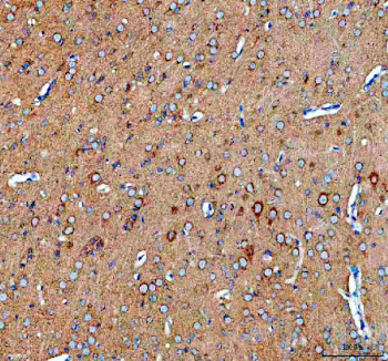 IHC staining of FFPE rat brain tissue with SEC22B antibody. HIER: boil tissue sections in pH8 EDTA for 20 min and allow to cool before testing.