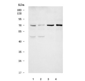 Western blot testing of 1) human HEL, 2) human Jurkat, 3) rat C6 and 4) mouse RAW264.7 cell lysate with TREML2 antibody. Predicted molecular weight ~35 kDa but may be observed at higher molecular weights due to glycosylation.