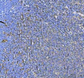 IHC staining of FFPE human tonsil tissue with SAMSN1 antibody. HIER: boil tissue sections in pH8 EDTA for 20 min and allow to cool before testing.