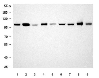 Western blot testing of 1) human HCCT, 2) human HCCP, 3) rat pancreas, 4) rat liver, 5) rat kidney, 6) rat RH35, 7) mouse pancreas, 8) mouse liver and 9) mouse kidney tissue lysate with Sarcosine dehydrogenase antibody. Predicted molecular weight ~101 kDa.