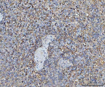 IHC staining of FFPE human spleen tissue with TRMT61B antibody. HIER: boil tissue sections in pH8 EDTA for 20 min and allow to cool before testing.