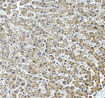 IHC staining of FFPE human liver tissue with PILT antibody, HRP-secondary and DAB substrate. HIER: boil tissue sections in pH8 EDTA for 20 min and allow to cool before testing.