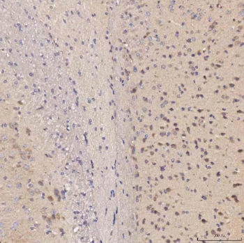 IHC staining of FFPE mouse brain tissue with Septin 11 antibody. HIER: boil tissue sections in pH8 EDTA for 20 min and allow to cool before testing.