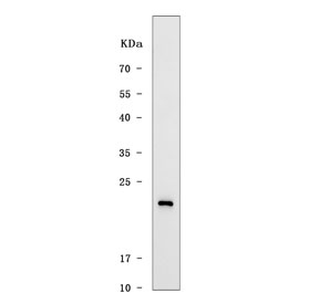 Western blot testing of human MCF7 cell lysate with TMEM88 antibody. Predicted molecular weight ~17 kDa.