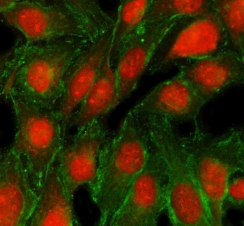Immunofluorescence analysis of TRMT5 expression. TRMT5 antibody (red) and Alpha Tubulin antibody (green) staining was performed on immunocytochemical sections of human U2OS cells, with nuclear counterstaining using DAPI (blue). TRMT5 signal is observed in both nuclear and cytoplasmic compartments, consistent with reported TRMT5 localization, while Alpha Tubulin highlights the microtubule network. Cells were blocked with goat serum and incubated with rabbit anti-TRMT5 antibody and mouse anti-Alpha Tubulin antibody overnight at 4 degrees C, followed by Cy3-conjugated goat anti-rabbit IgG and DyLight 488-conjugated goat anti-mouse IgG secondary antibodies, and images were acquired using a fluorescence microscope with appropriate filter sets.