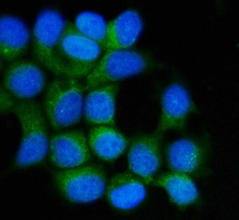 Hsp90 beta Antibody MCF-7 Cell IF. Immunofluorescence analysis of FFPE human MCF-7 cells using Hsp90 beta Antibody. Heat induced antigen retrieval was performed by steaming sections in pH 6 citrate buffer for 20 minutes prior to staining. Hsp90 beta is detected in green, with DAPI (blue) used as a nuclear counterstain. Strong diffuse cytoplasmic staining is observed throughout the cells, consistent with the constitutive cytosolic localization of HSP90AB1 as an ATP-dependent molecular chaperone involved in protein folding and protein homeostasis. These results support the use of Hsp90 beta Antibody / Heat Shock Protein 90 Beta Antibody for studying HSP90AB1 expression, molecular chaperone function and cellular stress responses.