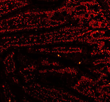 Immunofluorescent staining of FFPE mouse testis tissue with C-terminal-binding protein 2 antibody (red). HIER: steam section in pH8 EDTA buffer for 20 min.