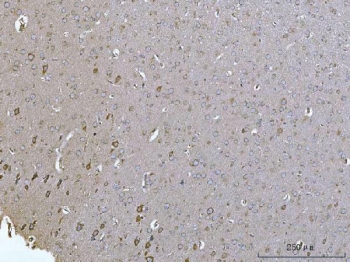 IHC staining of FFPE rat brain tissue with SELT antibody. HIER: boil tissue sections in pH8 EDTA for 20 min and allow to cool before testing.