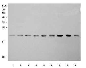 Western blot testing of 1) human A431, 2) human U-251, 3) human Caco-2, 4) human MCF7, 5) human T-47D, 6) human RT4, 7) rat pancreas, 8) mouse pancreas and 9) mouse NIH 3T3 cell lysate with SELT antibody. Predicted molecular weight ~22 kDa.