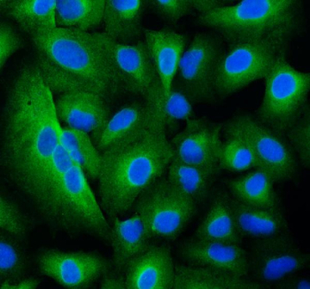 Immunofluorescent staining of FFPE human A549 cells with TRIM16 antibody (green) and DAPI nuclear stain (blue). HIER: steam section in pH6 citrate buffer for 20 min.
