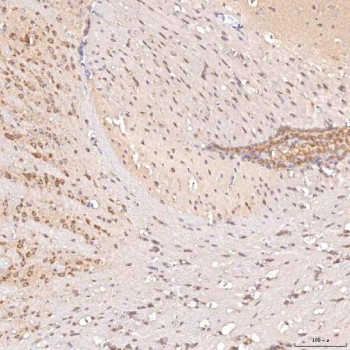 IHC staining of FFPE mouse brain tissue with SGCE antibody. HIER: boil tissue sections in pH8 EDTA for 20 min and allow to cool before testing.