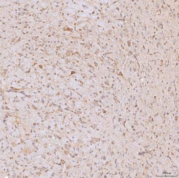 IHC staining of FFPE rat brain tissue with SGCE antibody. HIER: boil tissue sections in pH8 EDTA for 20 min and allow to cool before testing.
