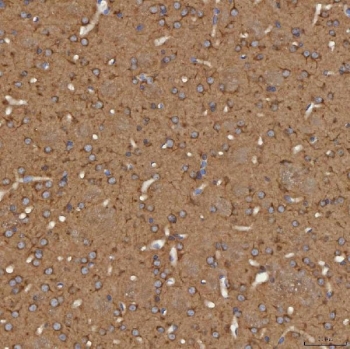 IHC staining of FFPE mouse brain tissue with SEC31A antibody. HIER: boil tissue sections in pH8 EDTA for 20 min and allow to cool before testing.