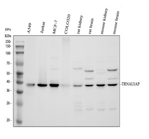 TRNAU1AP Antibody by WB in Human, Rat, and Mouse Samples. Western blot analysis of SECp43 in human A549 (lane 1), Jurkat (lane 2), MCF-7 (lane 3), and COLO320 (lane 4) cell lysates, rat kidney (lane 5), rat brain (lane 6), mouse kidney (lane 7), and mouse brain (lane 8) tissue lysates. Samples were separated by 10% SDS-PAGE under reducing conditions. The rabbit polyclonal antibody detects a principal band at approximately 38 kDa across all eight samples, compared with the calculated molecular weight of approximately 32.5 kDa. Additional higher-molecular-weight bands are visible in several samples.