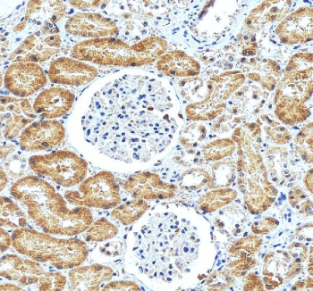 IHC staining of FFPE human kidney tissue with ATF6 antibody, HRP-secondary and DAB substrate. HIER: boil tissue sections in pH8 EDTA for 20 min and allow to cool before testing.
