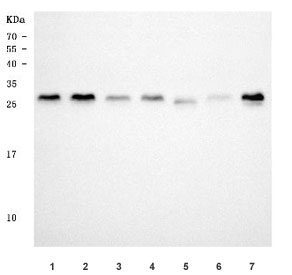 Western blot testing of 1) human HeLa, 2) human 293T, 3) human A549, 4) human MCF7, 5) rat brain, 6) mouse kidney and 7) mouse brain tissue with TSR2 antibody. Predicted molecular weight ~23 kDa, commonly observed at 23-30 kDa.
