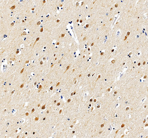 SMARCB1 Antibody by IHC in Human Cerebral Cortex Immunohistochemistry of FFPE human cerebral cortex sections using SMARCB1 Antibody at 2 ug/ml. Strong nuclear labeling is visible in numerous neurons, while the surrounding neuropil shows comparatively weaker staining. The prominent neuronal nuclear signal is consistent with the expected localization of SMARCB1/INI1. This INI1 Polyclonal Antibody was tested following heat-induced epitope retrieval in EDTA buffer.