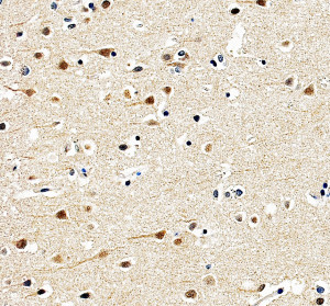 SMARCB1 Antibody by IHC in Cortical Neurons Immunohistochemistry of FFPE human cerebral cortex sections using SMARCB1 Antibody at 2 ug/ml. Numerous neurons exhibit distinct nuclear staining, with variation in signal intensity among individual cells. The staining demonstrates nuclear localization of SMARCB1/INI1 within cortical neurons. This INI1 Polyclonal Antibody was tested following heat-induced epitope retrieval in EDTA buffer.