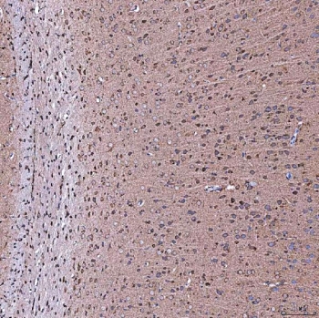 IHC staining of FFPE rat brain tissue with SERAC1 antibody. HIER: boil tissue sections in pH8 EDTA for 20 min and allow to cool before testing.