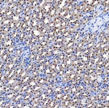 IHC staining of FFPE rat kidney tissue with SF3a120 antibody. HIER: boil tissue sections in pH8 EDTA for 20 min and allow to cool before testing.