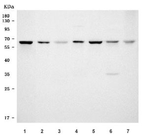 Western blot testing of 1) human HeLa, 2) human A431, 3) human HL60, 4) rat liver, 5) rat C6, 6) mouse liver and 7) mouse NIH 3T3 cell lysate with SF3a60 antibody. Predicted molecular weight ~59 kDa.