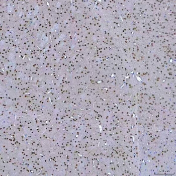 IHC staining of FFPE mouse brain tissue with SF3a60 antibody. HIER: boil tissue sections in pH8 EDTA for 20 min and allow to cool before testing.