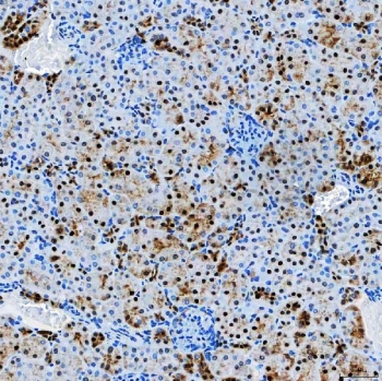 IHC staining of FFPE mouse kidney tissue with SF3a60 antibody. HIER: boil tissue sections in pH8 EDTA for 20 min and allow to cool before testing.