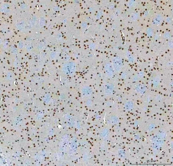 IHC staining of FFPE rat brain tissue with SF3a60 antibody. HIER: boil tissue sections in pH8 EDTA for 20 min and allow to cool before testing.