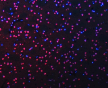 Immunofluorescent staining of FFPE mouse brain tissue with RNA-binding protein 22 antibody (red) and DAPI nuclear stain (blue). HIER: steam section in pH8 EDTA buffer for 20 min.