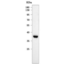 Western blot testing of human Raji cell lysate with RASSF2 antibody. Predicted molecular weight ~38 kDa.