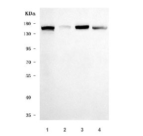 Desmoglein 2 Antibody Multi-Cell Line WB. Western blot analysis of human cell lysates using DSG2 antibody detecting Desmoglein 2. Lane 1: HeLa, Lane 2: K562, Lane 3: HepG2, Lane 4: A549. A band is detected at approximately 130-160 kDa, consistent with the predicted molecular weight of Desmoglein 2, with variation reflecting glycosylation of this transmembrane desmosomal cadherin. Stronger signal in epithelial-derived cell lines such as HeLa, HepG2, and A549 aligns with DSG2 expression in cells forming desmosomal adhesion complexes that support intercellular junction integrity.