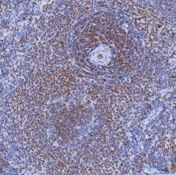 IHC staining of FFPE rat spleen tissue with TRMT61A antibody. HIER: boil tissue sections in pH8 EDTA for 20 min and allow to cool before testing.