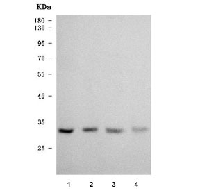 Western blot testing of human 1) PC-3, 2) Caco-2, 3) MCF7 and 4) HaCaT cell lysate with TRMT61A/tRNA methyltransferase 61A antibody. Predicted molecular weight ~31 kDa.
