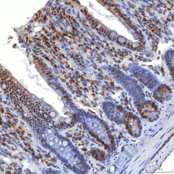 IHC staining of FFPE rat colon tissue with TRMT61A antibody. HIER: boil tissue sections in pH8 EDTA for 20 min and allow to cool before testing.