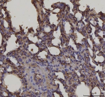 IHC staining of FFPE rat lung tissue with AGER antibody. HIER: boil tissue sections in pH8 EDTA for 20 min and allow to cool before testing.