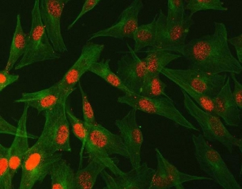 Immunofluorescent staining of FFPE human U-87 MG cells with Abelson interactor 2 antibody (red) and Beta Tubulin mAb (green). HIER: steam section in pH6 citrate buffer for 20 min.