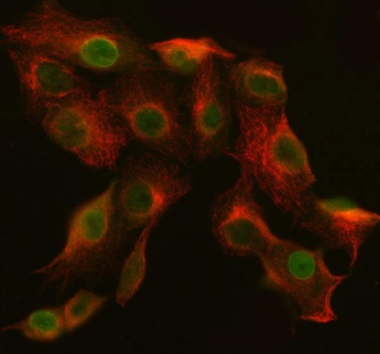 Immunofluorescent staining of FFPE human A549 cells with Abelson interactor 2 antibody (green) and Beta Tubulin mAb (red). HIER: steam section in pH6 citrate buffer for 20 min.