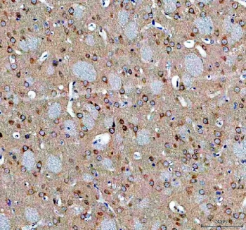IHC staining of FFPE rat brain tissue with Abelson interactor 2 antibody. HIER: boil tissue sections in pH8 EDTA for 20 min and allow to cool before testing.