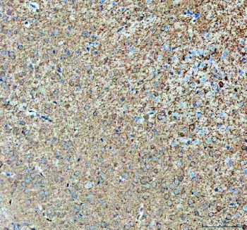 IHC staining of FFPE mouse brain tissue with Abelson interactor 2 antibody. HIER: boil tissue sections in pH8 EDTA for 20 min and allow to cool before testing.
