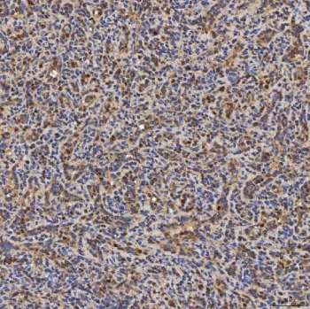 IHC staining of FFPE human spleen tissue with SLC25A24 antibody. HIER: boil tissue sections in pH8 EDTA for 20 min and allow to cool before testing.