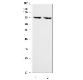CD105 Antibody SiHa HeLa WB. Western blot analysis of human SiHa and HeLa cell lysates using CD105 Antibody detects bands at approximately 70-90 kDa, consistent with the predicted molecular weight of Endoglin / CD105 monomer in unmodified and glycosylated forms, along with higher molecular weight bands at approximately 140-180 kDa corresponding to dimeric species of this membrane glycoprotein.