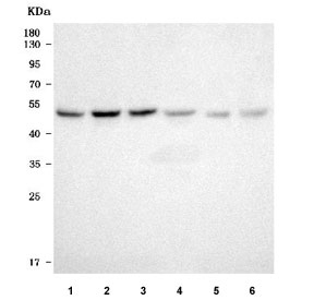 Western blot testing of 1) human 293T, 2) human HeLa, 3) human A549, 4) human HepG2, 5) rat stomach and 6) mouse ovary tissue lysate with TXNDC5 antibody. Predicted molecular weight ~48 kDa.