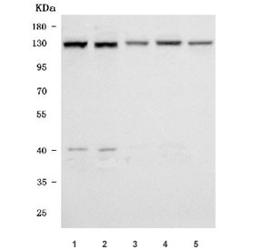 Western blot testing of 1) human K562, 2) human HEL, 3) human A431, 4) human U-251 and 5) rat testis tissue lysate with SMC6 antibody. Predicted molecular weight ~126 kDa.
