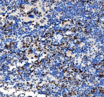 IHC staining of FFPE mouse spleen tissue with PAO-1 antibody, HRP-secondary and DAB substrate. HIER: boil tissue sections in pH8 EDTA for 20 min and allow to cool before testing.